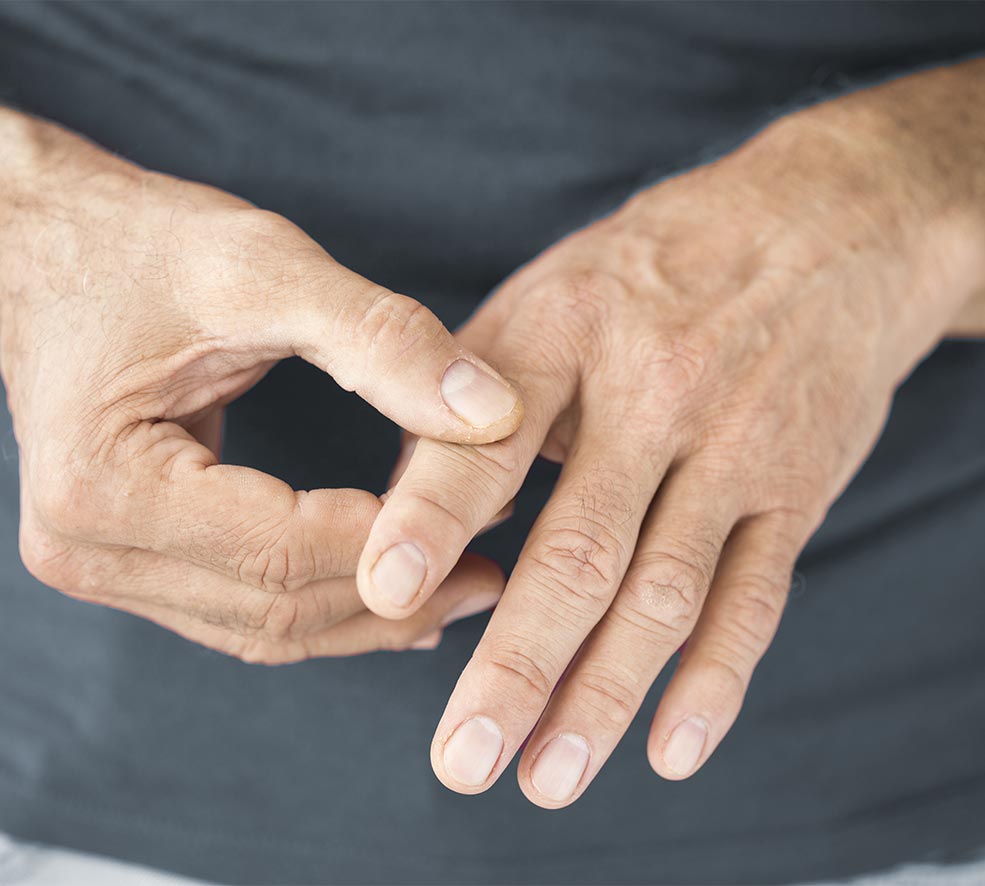Arthrose aux doigts : quels symptômes ? Qui est à risque ?