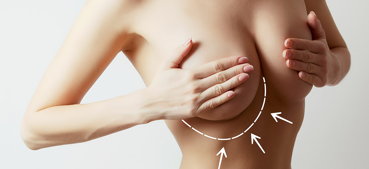Section Réduction mammaire
